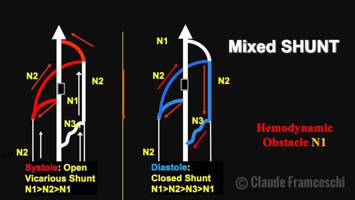 CHIVA理论：混合分流通路（Mixed Shunt）基础
