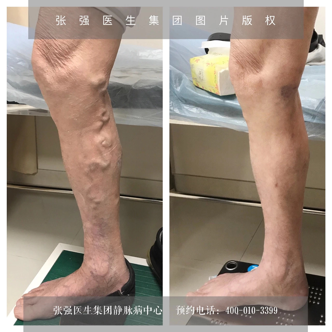 离婚男女